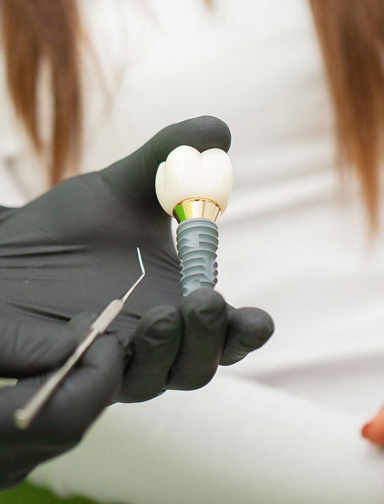 single implant