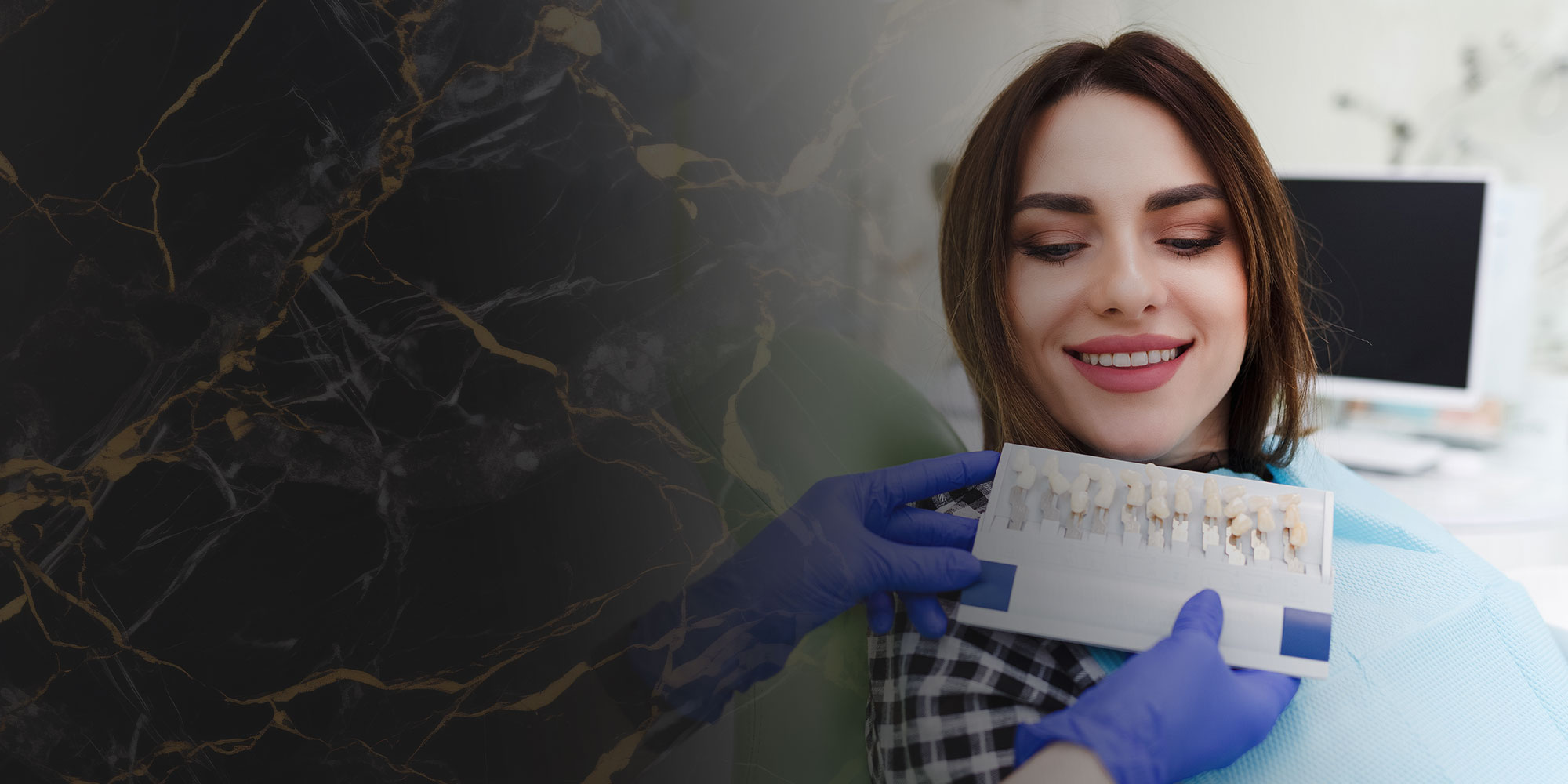dental veneer patient