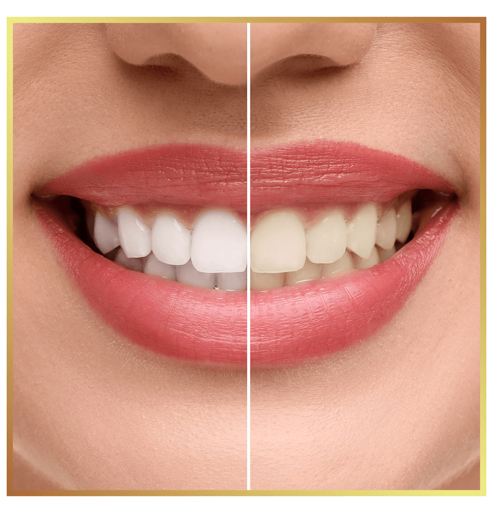 whitening why choose ba