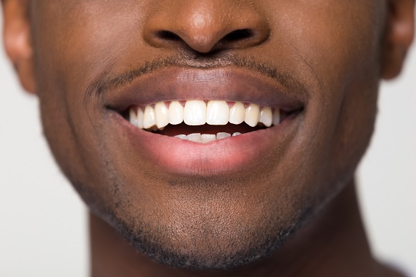 Teeth Whitening Hallandale Beach, FL